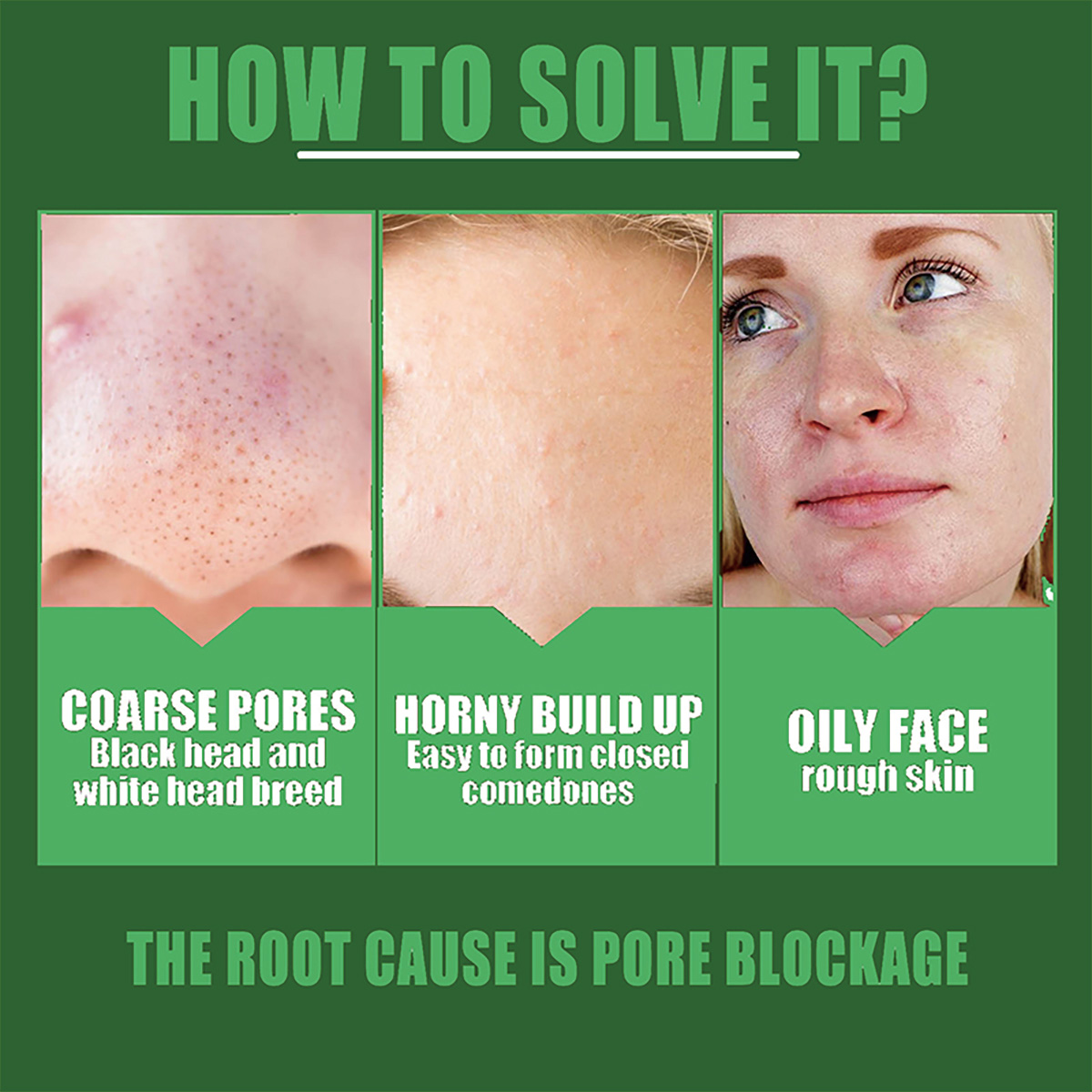 Shrink pores Remove acne marks - مراجعة Licorice Root Sticks وسعره